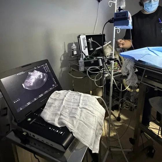 Aparelho de ultrassom e monitor multiparamétrico montados no centro cirúrgico